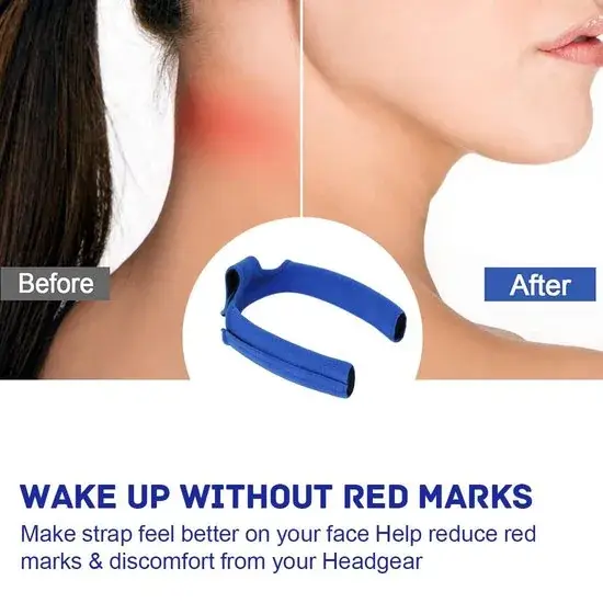 Blauwe zachte hoes voor de band van een CPAP-masker, met vergelijking Before en After van rode drukplekken op de wang, tekst Wake up without red marks